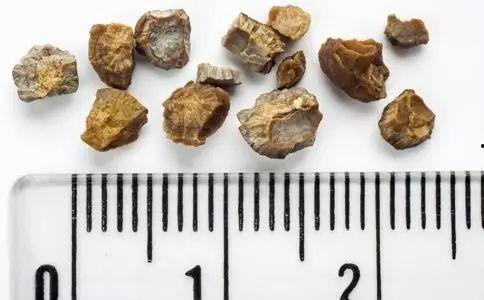 肾结石吃玉瓜好不好,肾结石患者食用玉瓜的利弊分析